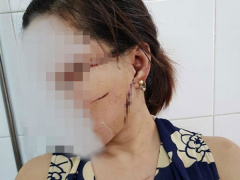 Ảnh bìa bài viết 584377