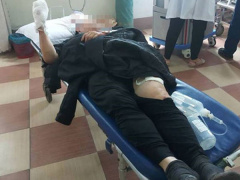 Ảnh bìa bài viết 587695