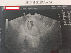 Ảnh bìa bài viết 588873