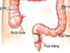 Ảnh bìa bài viết 589943