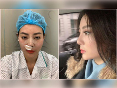 Ảnh bìa bài viết 592404