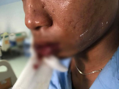 Ảnh bìa bài viết 605520