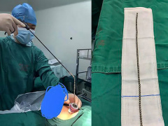 Ảnh bìa bài viết 608230