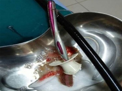 Ảnh bìa bài viết 609644