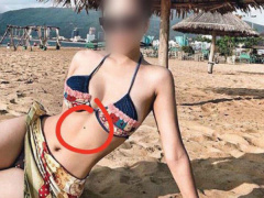Ảnh bìa bài viết 611493