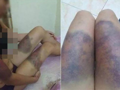Ảnh bìa bài viết 611755