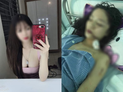 Ảnh bìa bài viết 613323