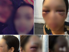 Ảnh bìa bài viết 617045