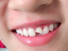 Ảnh bìa bài viết 620552