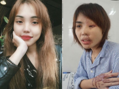 Ảnh bìa bài viết 621778