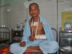Ảnh bìa bài viết 280789