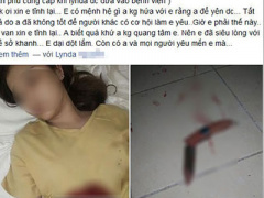 Ảnh bìa bài viết 281267