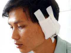 Ảnh bìa bài viết 286642