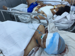 Ảnh bìa bài viết 288448