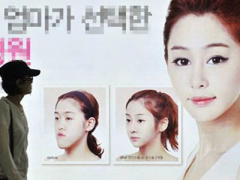 Ảnh bìa bài viết 288660
