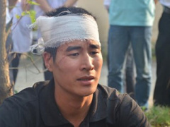Ảnh bìa bài viết 290238