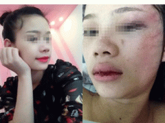 Ảnh bìa bài viết 293624