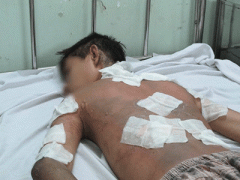 Ảnh bìa bài viết 295135