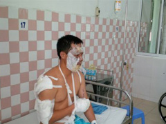 Ảnh bìa bài viết 296489