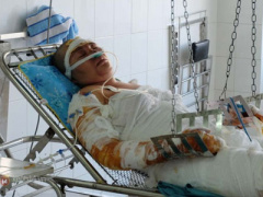 Ảnh bìa bài viết 298551