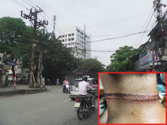 Ảnh bìa bài viết 298997
