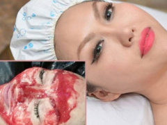 Ảnh bìa bài viết 303603