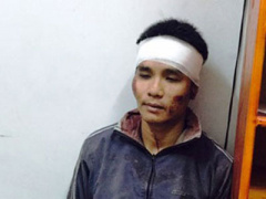 Ảnh bìa bài viết 305585