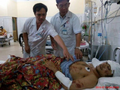 Ảnh bìa bài viết 309987