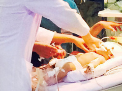 Ảnh bìa bài viết 311605