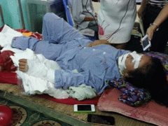 Ảnh bìa bài viết 312043