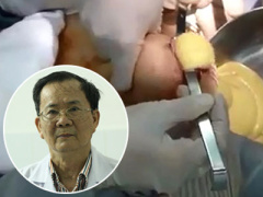 Ảnh bìa bài viết 312974