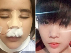 Ảnh bìa bài viết 313478