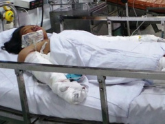 Ảnh bìa bài viết 314639