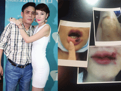 Ảnh bìa bài viết 315466
