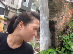 Ảnh bìa bài viết 315913