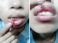 Ảnh bìa bài viết 316500