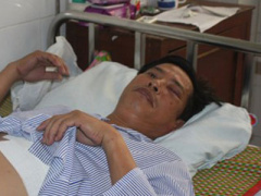 Ảnh bìa bài viết 318546
