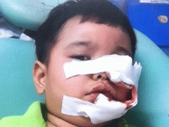 Ảnh bìa bài viết 321150