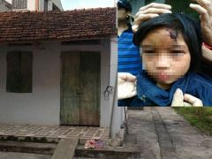 Ảnh bìa bài viết 322385