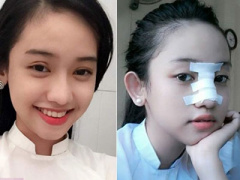 Ảnh bìa bài viết 322523