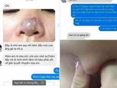 Ảnh bìa bài viết 322802