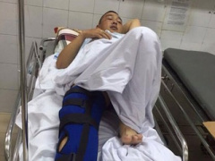 Ảnh bìa bài viết 323488