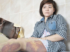 Ảnh bìa bài viết 324607