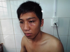 Ảnh bìa bài viết 324856