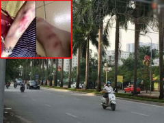 Ảnh bìa bài viết 328853