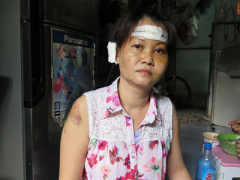 Ảnh bìa bài viết 330247
