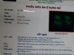 Ảnh bìa bài viết 330193