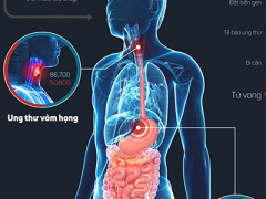 Ảnh bìa bài viết 331488
