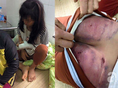 Ảnh bìa bài viết 333295