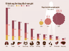 Ảnh bìa bài viết 333428